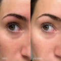 Faded Brightening under Eye Masks | Patches to Depuff, Hydrate, Brighten and Cool | Reduce Dark Circles and Fine Lines | Contains Kojic Acid, Caffeine and Niacinamide (Set of 6)