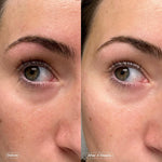Faded Brightening under Eye Masks | Patches to Depuff, Hydrate, Brighten and Cool | Reduce Dark Circles and Fine Lines | Contains Kojic Acid, Caffeine and Niacinamide (Set of 6)