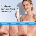 Skin Scrubber Face Spatula Skin Spatula Pore Cleaner Blackhead Remover Tools for Facial Deep Cleansing-4 Modes -White