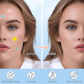 Pimple Patches for Face, Hydrocolloid Acne Patches, Cute Star Zit Covers, Colorful Spot Stickers with Tea Tree, Salicylic Acid & Cica Oil| 3 Sizes (10Mm, 12Mm & 14Mm) |200 Count